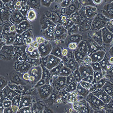 2014_09_25_Ploss_HepC-vaccine120 2014_09_25_Ploss_HepC-vaccine120